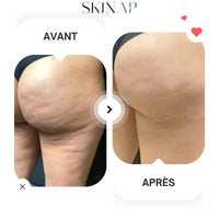 Skinap® - Appareil de massage Raffermissant