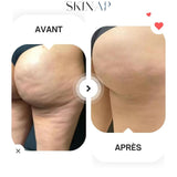 Skinap® - Appareil de massage Raffermissant