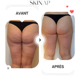 Skinap® - Appareil de massage Raffermissant